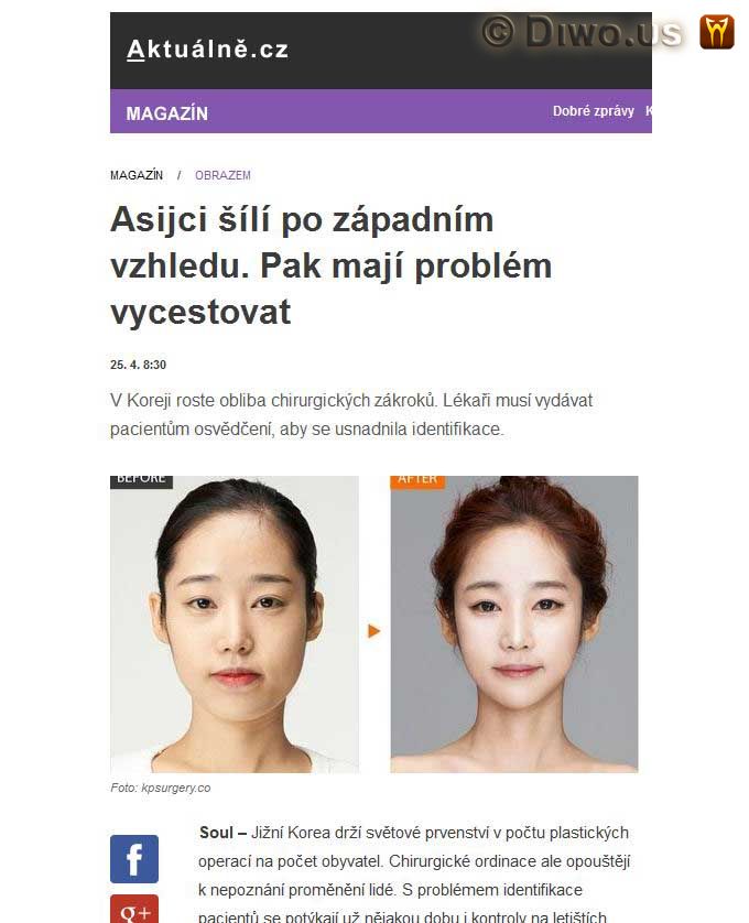 Diwous - Asiaté, identifikace, Jižní Korea, módní trend, plastická operace, plastika obličeje